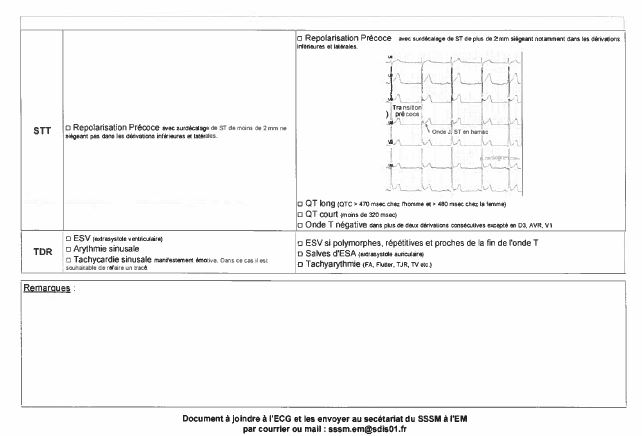 fiche-pratique-ecg2